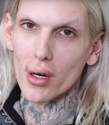Top 8 Jeffree Star No Makeup Pictures Revealed