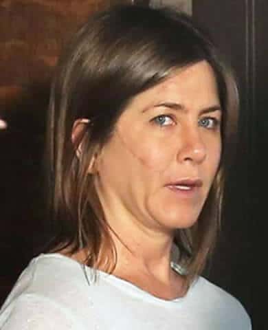 Jennifer Aniston Scar Face