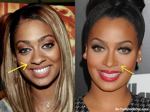 Lala Anthony Plastic Surgery Comparison Photos