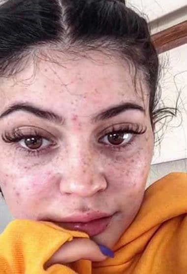 15 Kylie Jenner No Makeup Pics Proved She S Human