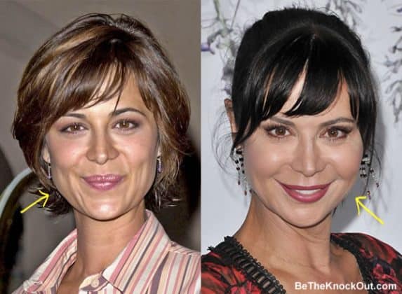 Catherine Bell Plastic Surgery Comparison Photos