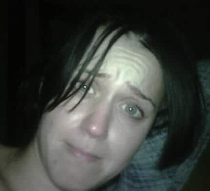 Katy Perry showing some worrying signs on her face