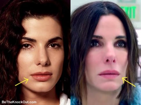 Sandra Bullock Plastic Surgery Comparison Photos