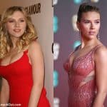 Did Scarlett Johansson get a breast reduction?