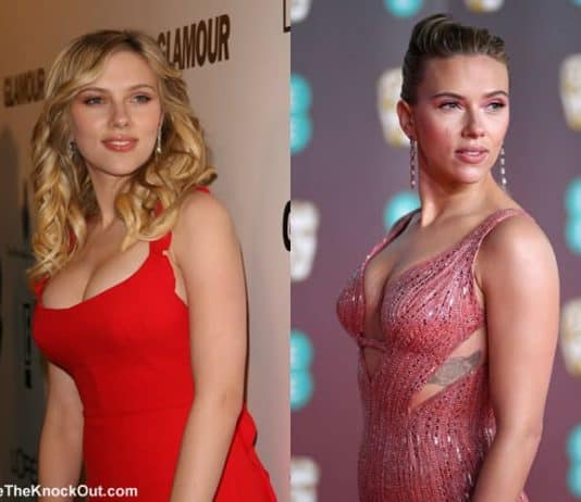 Did Scarlett Johansson get a breast reduction? 