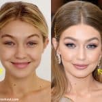 Gigi Hadid botox before and after comparison photo