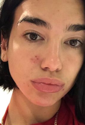 Top 7 Dua Lipa Without Makeup Pictures Revealed