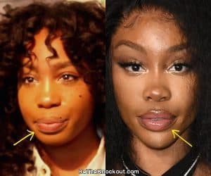 SZA Plastic Surgery Comparison Photos