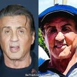 Did Sylvester Stallone have botox?