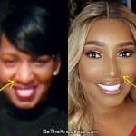 Nene Leakes nose job before and after comparison photo