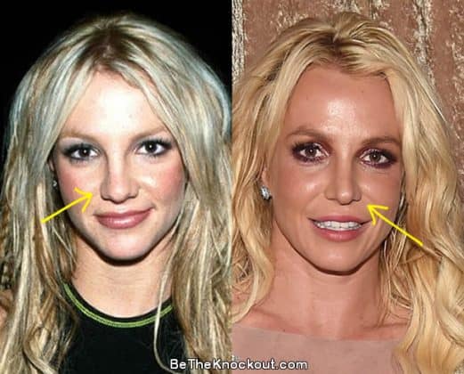 Britney Spears Plastic Surgery Comparison Photos britney-spears-plastic-surgery-comparison-photos