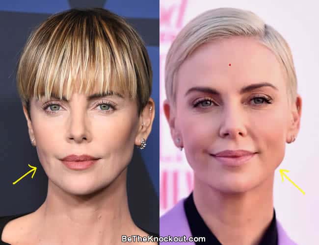 Charlize Theron Plastic Surgery Comparison Photos