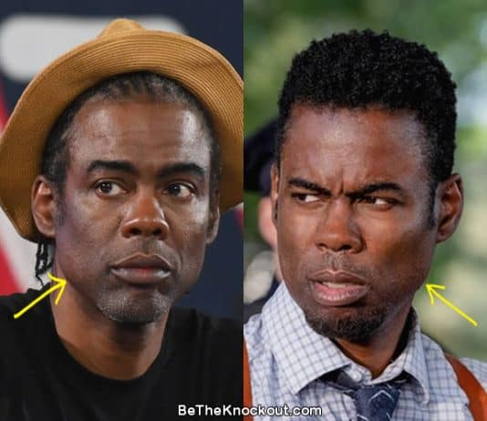 Chris Rock facelift before and after comparison photo