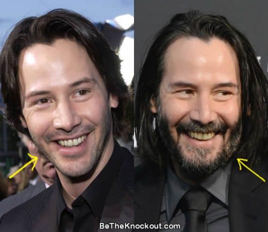 Keanu Reeves botox before and after comparison photo