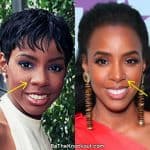 Kelly Rowland nose job before and after comparison photo