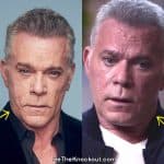 Ray Liotta botox before and after comparison photo