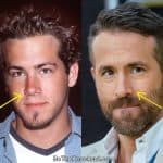 Ryan Reynolds nose job before and after comparison photo