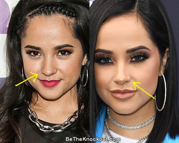 Becky G nose job before and after comparison photo