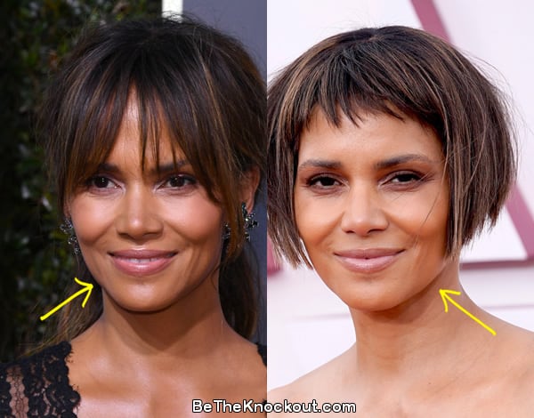 Halle Berry botox before and after comparison photo