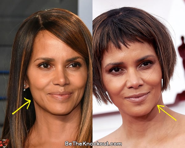 Halle Berry facelift before and after comparison photo