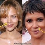 Halle Berry nose job before and after comparison photo