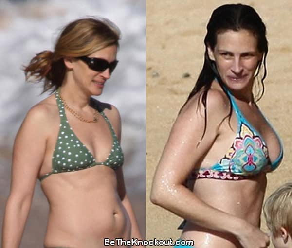 Julia Roberts boob job before and after comparison photo