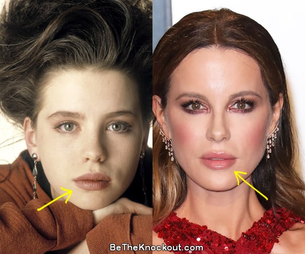 Kate Beckinsale before and after comparison photo