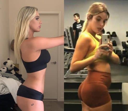 Lele Pons butt lift before and after comparison photo