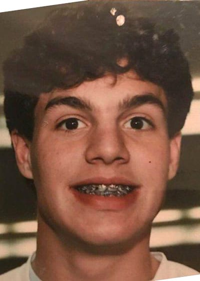 Mark Ruffalo with braces as a teenager