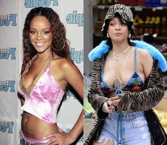 Rihanna boob job before and after comparison photo