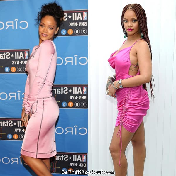 Rihanna butt lift before and after comparison photo