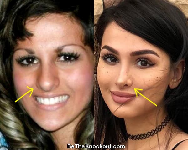 sssniperwolf nose job before and after comparison photo