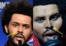 The Weeknd nose job before and after comparison photo