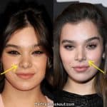 Hailee Steinfeld nose job before and after comparison photo