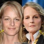 Helen Hunt facelift before and after comparison photo