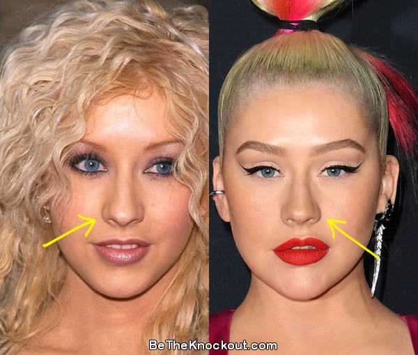 Christina Aguilera Plastic Surgery Comparison Photos